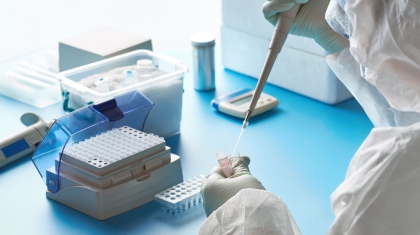 Badania PCR: porównanie wyników z moczu i nasienia