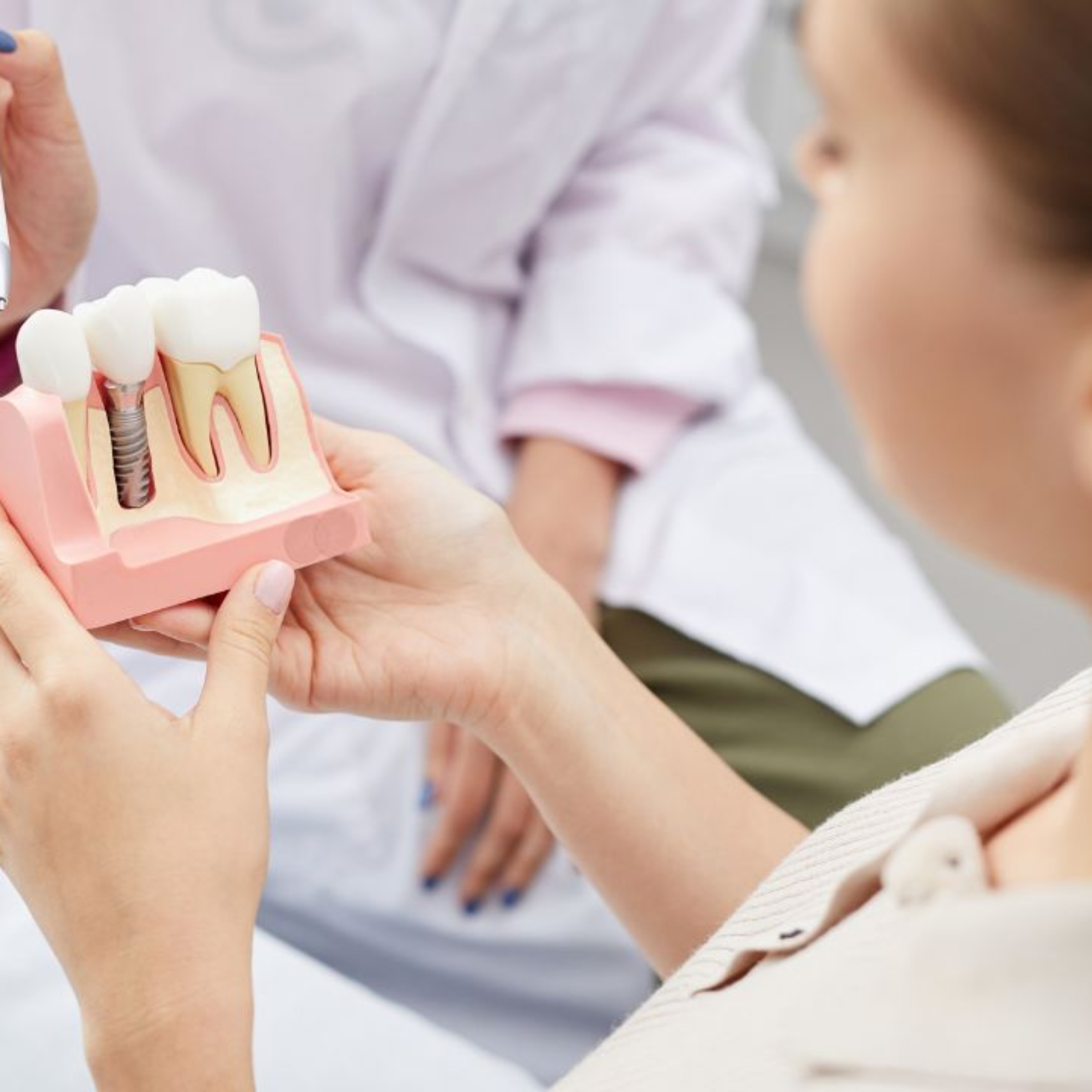 Bezbolesne rozwiązanie dla utraty zębów: Implanty zębowe