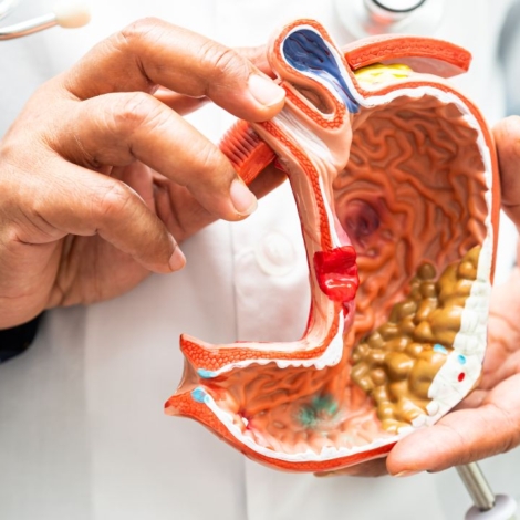 Choroby układu pokarmowego - jak zapobiegać i skutecznie leczyć?