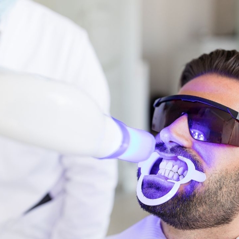 Nowoczesne metody wybielania zębów: jakie techniki warto wybrać?