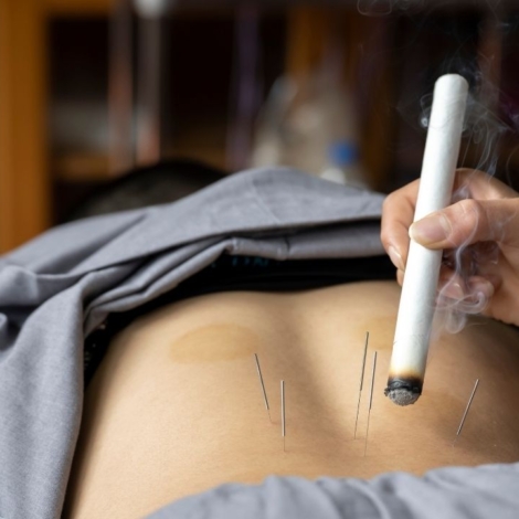 Moksoterapia: skuteczne leczenie różnych dolegliwości i jej działanie w praktyce