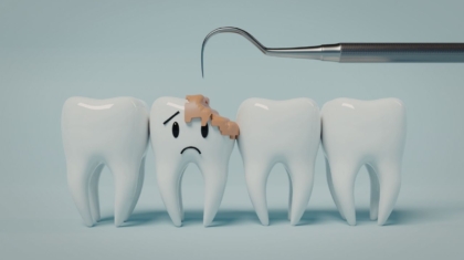 Próchnica: jak ją rozpoznać zanim będzie za późno?